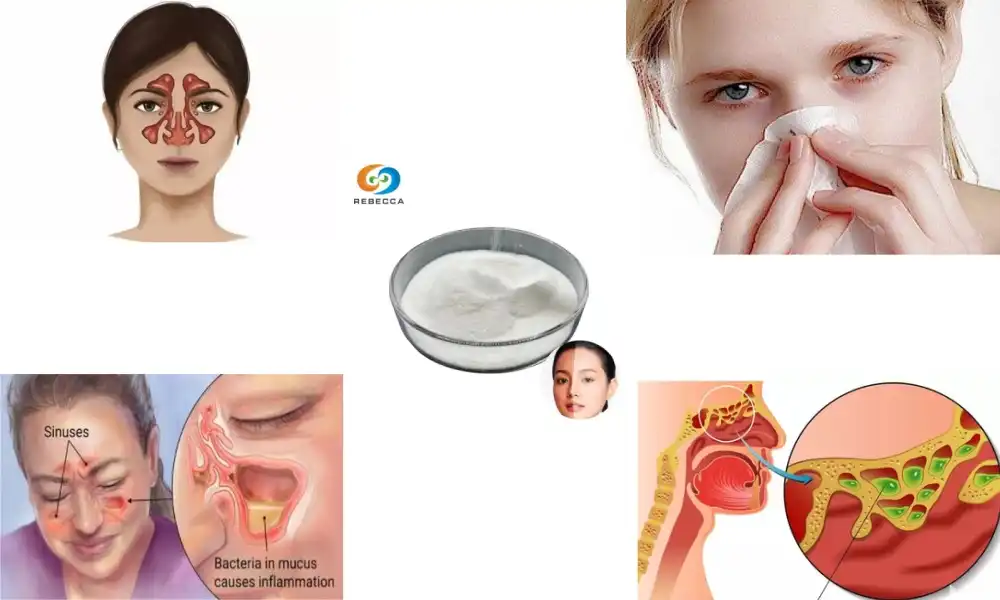 How to take bromelain powder for sinusitis?